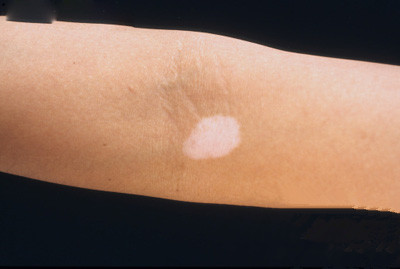 ÀÏÄê°×ñ°·ç ÀÏÄê°×ñ°·ç